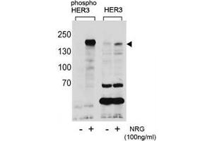 Western blot analysis of extracts from T47D cells, untreated or treated with NRG, using phospho-HER3 antibody (left) or nonphos Ab (right). (ERBB3 Antikörper  (pTyr1289))