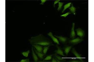 Immunofluorescence (IF) image for anti-Cytidine and DCMP Deaminase Domain Containing 1 (CDADC1) (AA 1-514) antibody (ABIN949692)