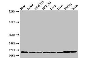 Western Blot Positive WB detected in: Hela whole cell lysate, Jurkat whole cell lysate, SH-SY5Y whole cell lysate, HEK293 whole cell lysate, Mouse lung tissue, Mouse liver tissue, Mouse kidney tissue, Mouse brain tissue All lanes: PAIP2 antibody at 3. (PAIP2 Antikörper  (AA 1-127))