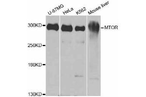 Western blot analysis of extracts of various cell lines, using MTOR antibody. (MTOR Antikörper  (AA 2388-2487))