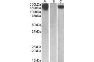 HEK293 lysate (10ug protein in RIPA buffer) overexpressing Human CSF1R with C-terminal MYC tag probed with AP22413PU-N(0. (CSF1R Antikörper  (Internal Region))