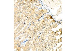 Immunohistochemistry (Paraffin-embedded Sections) (IHC (p)) image for anti-Keratin 13 (KRT13) (C-Term) antibody (ABIN7074411)