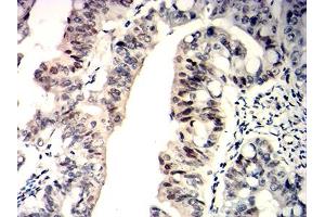 Immunohistochemistry (IHC) image for anti-Wilms Tumor 1 (WT1) (AA 1-181) antibody (ABIN7193614)