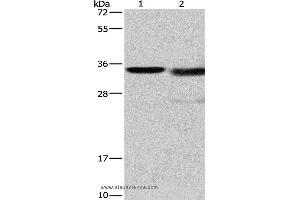 Western blot analysis of Mouse kidney tissue and A172 cell, using CTSL Polyclonal Antibody at dilution of 1:900 (Cathepsin L Antikörper)