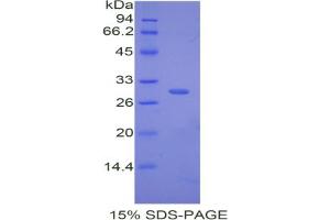 SDS-PAGE analysis of Mouse Complement Factor D Protein. (Adipsin Protein)