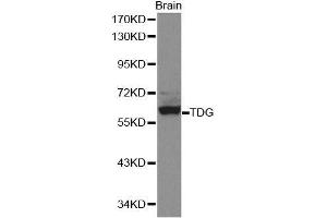 Western blot analysis of extracts of mouse brain, using TDG antibody. (TDG Antikörper  (AA 1-160))