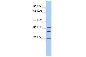 Calponin 1 antibody used at 1 ug/ml to detect target protein. (CNN1 Antikörper  (N-Term))