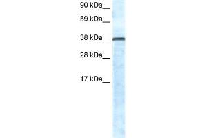 WB Suggested Anti-GFI1 Antibody Titration:  0. (GFI1 Antikörper  (N-Term))
