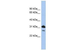 RAP1B antibody used at 1 ug/ml to detect target protein.