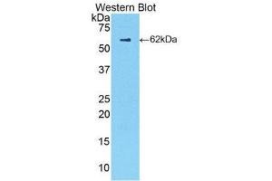 Western Blotting (WB) image for anti-Complement Factor B (CFB) (AA 34-159) antibody (ABIN3210066) (Complement Factor B Antikörper  (AA 34-159))
