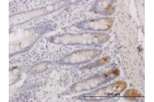 Immunoperoxidase of monoclonal antibody to SFRS17A on formalin-fixed paraffin-embedded human small Intestine. (SFRS17A Antikörper  (AA 53-156))