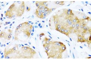 Immunohistochemistry of paraffin-embedded Human stomach using ACVR1C Polyclonal Antibody at dilution of 1:100 (40x lens). (ACVR1C/ALK7 Antikörper)