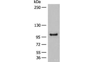 Western blot analysis of HEPG2 cell lysate using CTDP1 Polyclonal Antibody at dilution of 1:500 (CTDP1 Antikörper)