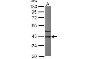 WB Image Sample (50 ug of whole cell lysate) A: Mouse brain 10% SDS PAGE antibody diluted at 1:1000 (G Protein alpha Inhibitor 3 (Center) Antikörper)