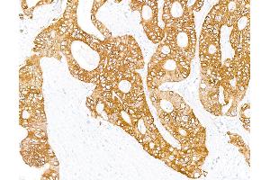 Immunohistochemistry (IHC) image for anti-Keratin 8 (KRT8) (C-Term) antibody (ABIN7795705)