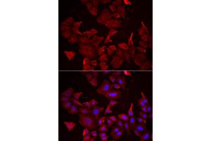 Immunofluorescence analysis of HeLa cells using CASP14 antibody (ABIN5973925). (CASP14 Antikörper)