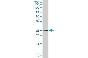 RALB MaxPab rabbit polyclonal antibody. (RALB Antikörper  (AA 1-206))