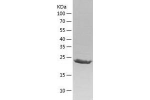 Western Blotting (WB) image for NK3 Homeobox 1 (NKX3-1) (AA 2-234) protein (His tag) (ABIN7124181) (NKX3-1 Protein (AA 2-234) (His tag))