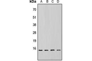 Western blot analysis of 4EBP1 (pT69) expression in HEK293T (A), NS-1 (B), H9C2 (C), rat liver (D) whole cell lysates. (eIF4EBP1 Antikörper  (pSer69))