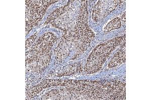 IHC analysis of TRMT61A using anti-TRMT61A antibody (ABIN7599220).