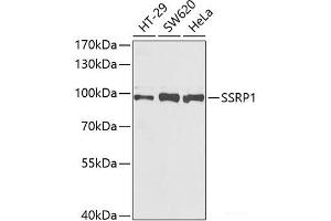 Western blot analysis of extracts of various cell lines using SSRP1 Polyclonal Antibody at dilution of 1:1000. (SSRP1 Antikörper)