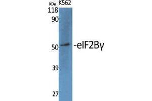 Western Blot (WB) analysis of specific cells using eIF2Bgamma Polyclonal Antibody. (EIF2B3 Antikörper  (Internal Region))