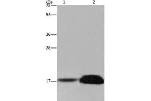 Western Blot analysis of Mouse kidney and Human kidney tissue using FHIT Polyclonal Antibody at dilution of 1:600 (FHIT Antikörper)
