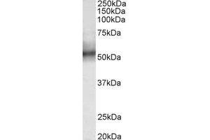 Western Blotting (WB) image for anti-Tripartite Motif Containing 11 (TRIM11) (Internal Region) antibody (ABIN2465007)
