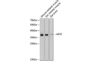 Western blot analysis of extracts of various cell lines using ART5 Polyclonal Antibody at dilution of 1:1000. (ART5 Antikörper)