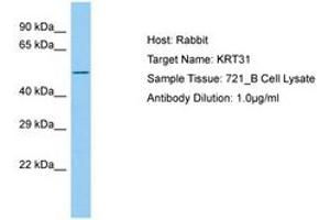 Image no. 1 for anti-Keratin 31 (KRT31) (AA 299-348) antibody (ABIN6750207) (Keratin 31 Antikörper  (AA 299-348))