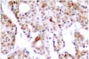 Image no. 1 for anti-Myc Proto-Oncogene protein (MYC) (pThr358) antibody (ABIN318074) (c-MYC Antikörper  (pThr358))