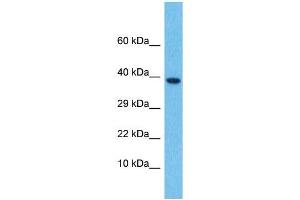 Host:  Rabbit  Target Name:  LEFTY2  Sample Type:  Thymus Tumor lysates  Antibody Dilution:  1. (LEFTY2 Antikörper  (N-Term))