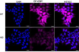 Immunocytochemical staining of HeLa cells using EIF4EBP1 antibody (ABIN7798532), 1:1,000), Top panel: wild-type (WT), Bottom panal: EIF4EBP1 shRNA knockdown (KD). (Rekombinanter eIF4EBP1 Antikörper)