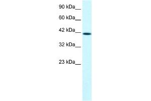 WB Suggested Anti-PTK2B Antibody Titration:  1. (PTK2B Antikörper  (C-Term))
