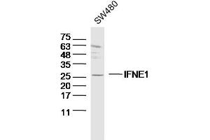SW480 lysates probed with IFNE1 Polyclonal Antibody, Unconjugated  at 1:300 dilution and 4˚C overnight incubation. (IFNE Antikörper  (AA 101-200))