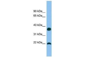 WFDC1 antibody used at 1 ug/ml to detect target protein. (WFDC1 Antikörper  (Middle Region))
