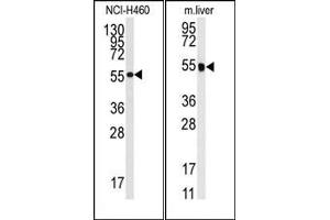 Image no. 1 for anti-Cytochrome P450, Family 2, Subfamily R, Polypeptide 1 (CYP2R1) (Middle Region) antibody (ABIN360263) (CYP2R1 Antikörper  (Middle Region))