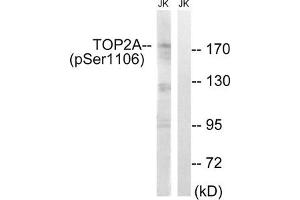 Western blot analysis of extracts from Jurkat cells, treated with paclitaxel (1uM, 24hours), using TOP2A (Phospho-Ser1106) antibody. (Topoisomerase II alpha Antikörper  (pSer1106))