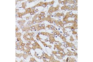 Immunohistochemistry of paraffin-embedded human liver using HDLBP antibody (ABIN6128051, ABIN6141701, ABIN6141702 and ABIN6221672) at dilution of 1:100 (40x lens). (HDLBP Antikörper  (AA 1035-1268))