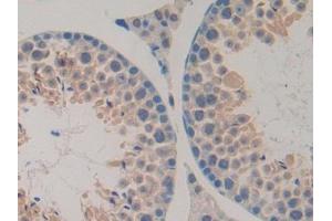 IHC-P analysis of Mouse Testis Tissue, with DAB staining.