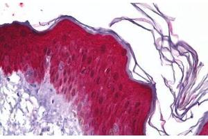 Anti-HSPB1 antibody IHC staining of human skin, epidermis.