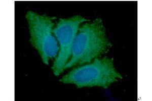 ICC/IF analysis of JAK2 in HeLa cells line, stained with DAPI (Blue) for nucleus staining and monoclonal anti-human JAK2 antibody (1:100) with goat anti-mouse IgG-Alexa fluor 488 conjugate (Green).