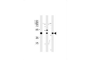 GTF2H2C Antibody (C-term) (ABIN655372 and ABIN2844928) western blot analysis in A549,K562,MCF-7 cell line lysates (35 μg/lane).