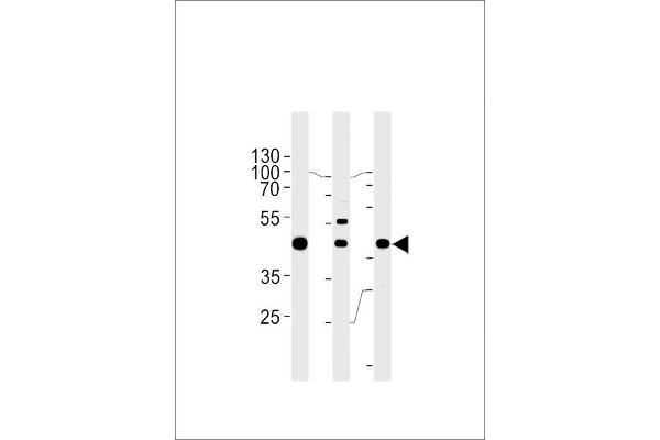 GTF2H2C 抗体  (C-Term)
