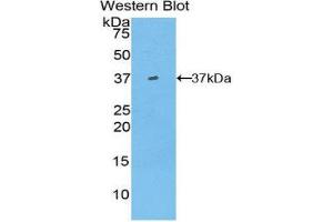Western Blotting (WB) image for anti-Hepcidin Antimicrobial Peptide (HAMP) (AA 23-82) antibody (ABIN1859135) (Hepcidin Antikörper  (AA 23-82))