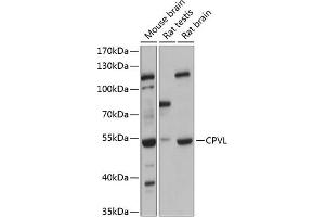 Western blot analysis of extracts of various cell lines, using CPVL antibody (ABIN6130825, ABIN6138985, ABIN6138987 and ABIN6215977) at 1:3000 dilution. (CPVL Antikörper  (AA 127-476))