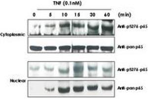 Image no. 3 for anti-Nuclear Factor-kB p65 (NFkBP65) (pSer276) antibody (ABIN1103942) (NF-kB p65 Antikörper  (pSer276))
