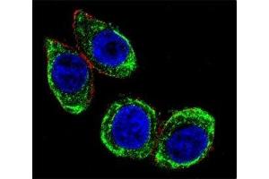 Confocal immunofluorescent analysis of Cytokeratin-18 antibody with HeLa cells followed by Alexa Fluor 488-conjugated goat anti-rabbit lgG (green). (Cytokeratin 18 Antikörper  (AA 401-430))
