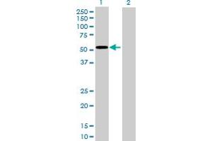 Western Blot analysis of GCK expression in transfected 293T cell line by GCK MaxPab polyclonal antibody.