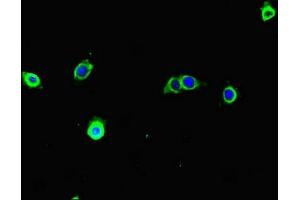 Immunofluorescent analysis of A375 cells using ABIN7171680 at dilution of 1:100 and Alexa Fluor 488-congugated AffiniPure Goat Anti-Rabbit IgG(H+L) (TECPR1 Antikörper  (AA 199-487))